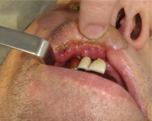 pic-10